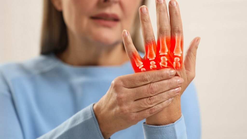 Arthritis Is Costing Canada $142.4 Billion a Year as Patient Count Heads From 6 Million Toward 10 Million